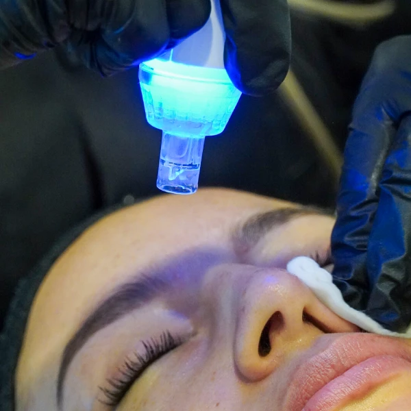 hydralinfusion en pozuelo de alarcon y aravaca precio