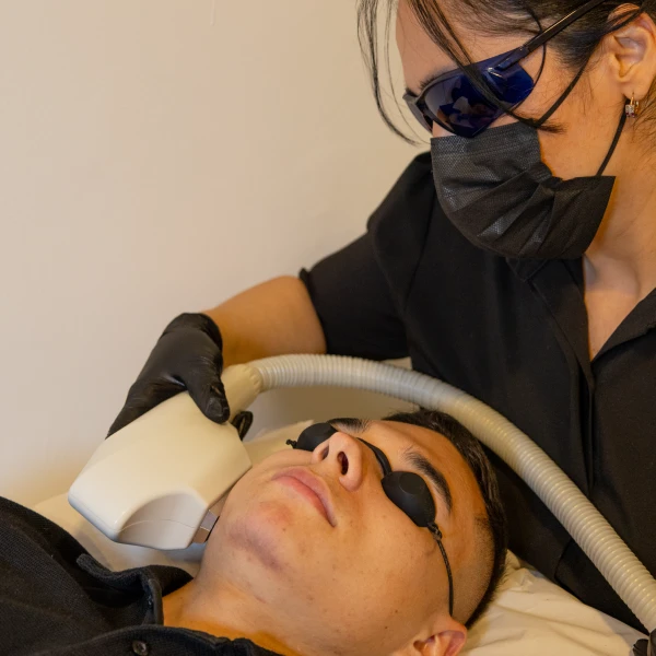 laser luz pulsada ipl facial pozuelo de alarcon y aravaca